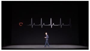 Is the apple watch worth buying?
